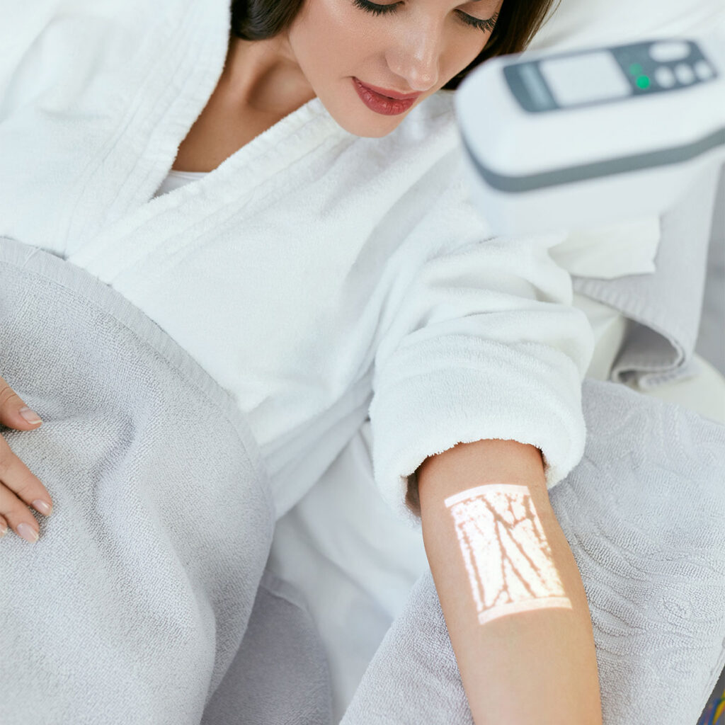 accuvein
